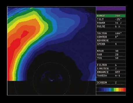 Sonar shows soft bottom to port